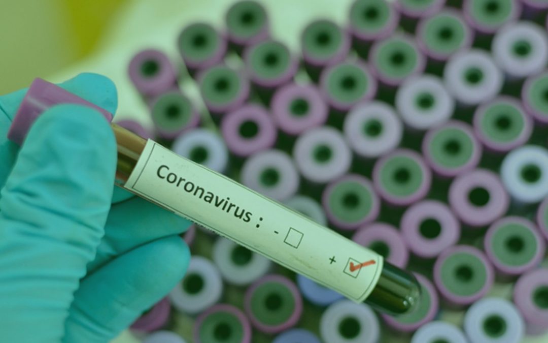 Como as startups se tornaram protagonistas no combate ao coronavírus